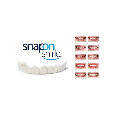 فروشگاه علی آوا1,690,000 ریاللمینت متحرک دندان SNAP ON SMILE کیفیت:AAA+|سلامت و زیبایی